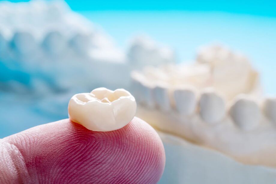 What Are the Different Types of Dental Crowns?